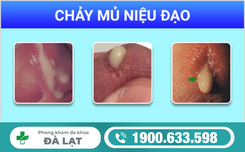 Hình ảnh minh họa